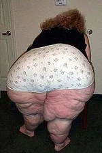 obese-hitthis.webp