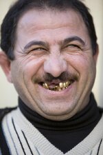 golden-teeth_2.jpg