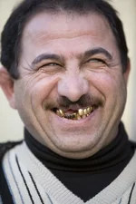 golden-teeth_2.webp