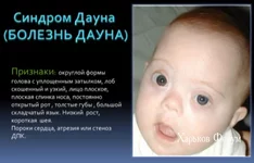 9c34fe3361941eb9.webp