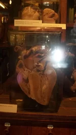 100_0712.webp