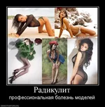 713056_radikulit.webp