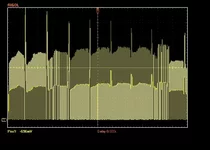 ecg.webp