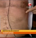 kernes4.webp