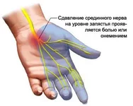 (1).webp