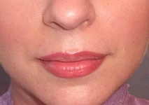  губ от виктории громовой.webp