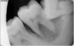 C1oNdBF7sZ4.webp