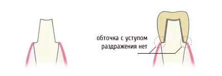  с уступом 11.webp