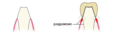  с уступом 12.webp