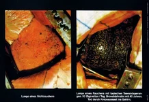 raucherlunge-propaganda.webp