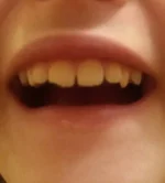 20170111_205042.webp