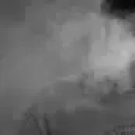 Phobias